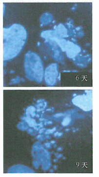 肿瘤化学治疗与有丝分裂灾难的研究