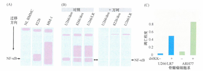为什么万珂能有效抑制骨髓瘤研究