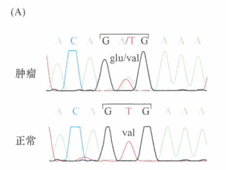 B-Braf研究在黑色素瘤中的进展