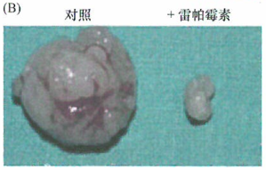 雷帕霉素的肿瘤治疗作用研究