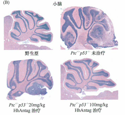 环巴胺及其类似物对肿瘤生长的影响研究