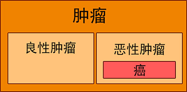 结直肠癌锯齿状息肉病综合征的研究