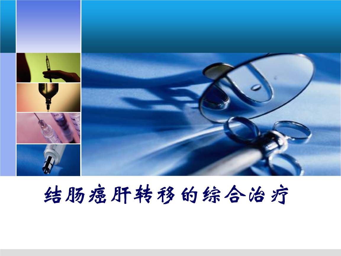 肝转移灶切除术是治愈肝转移病灶的更好方法