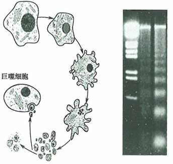 细胞凋亡与肿瘤的研究
