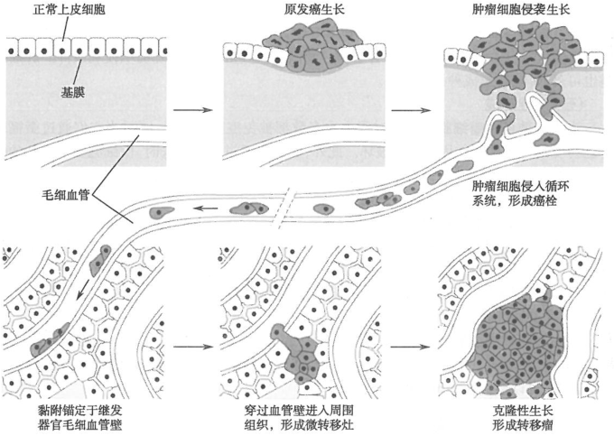 肿瘤侵袭、转移的基本过程研究