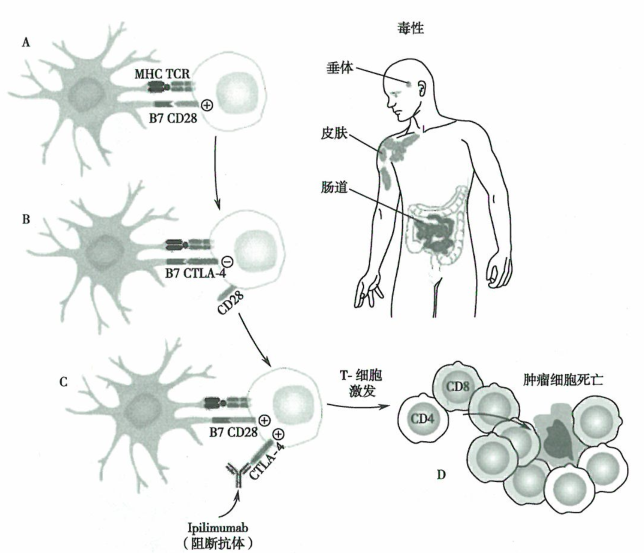 治疗晚期肺癌的疫苗I​pilimumab临床试验研究