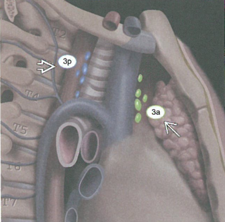 肺癌淋巴结分组和转移途径