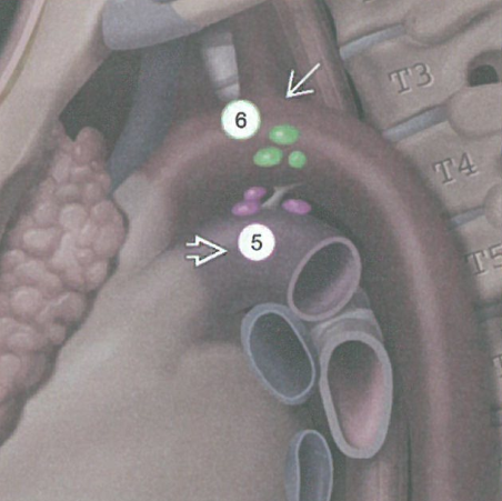 肺癌淋巴结分组和转移途径