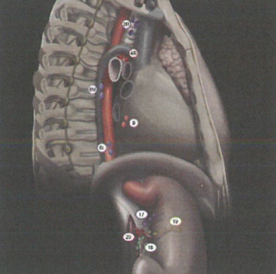 中国食管癌鳞癌占90%以上，食管癌​​​恶性肿瘤的介绍