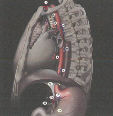 中国食管癌鳞癌占90%以上，食管癌​​​恶性肿瘤的介绍