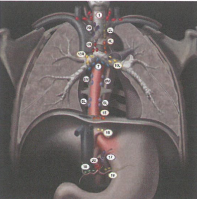 中国食管癌鳞癌占90%以上，食管癌​​​恶性肿瘤的介绍