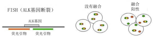ALK融合基因的检测方法