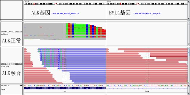 ALK融合基因的检测方法