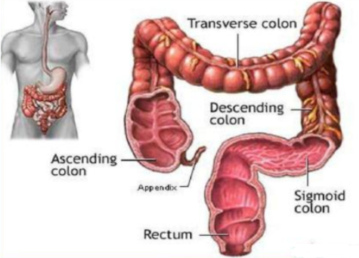 腺瘤性息肉病，家族性腺瘤性息肉病（FAP)
