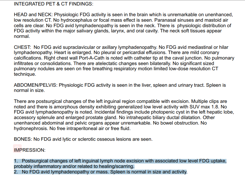 北京淋巴瘤患者赴美治疗后,体内癌细胞完全消失