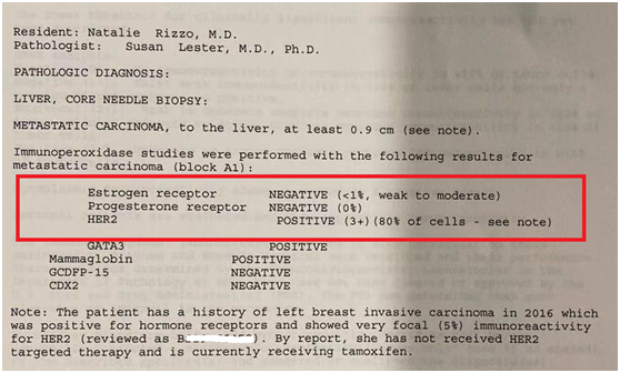 成功可以复制,美国这家医院再次治好晚期乳腺癌