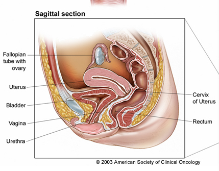 估计美国有6,230名女性被诊断出患有阴道癌