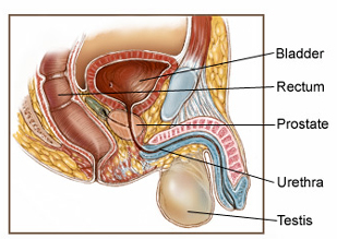 前列腺肿瘤一般生长缓慢，不会迅速扩散到身体的其他部位