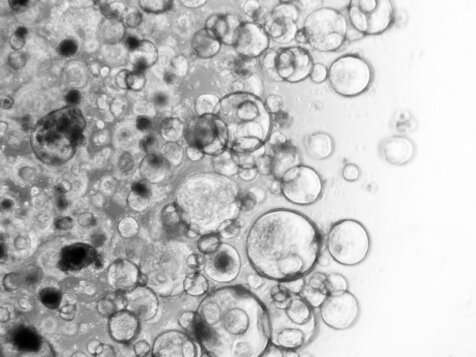 研究发现癌症起源的故事具有可预测的情节主线