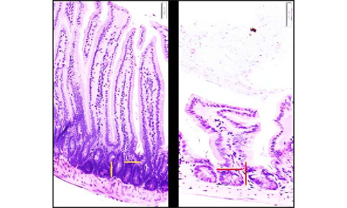 高脂肪饮食会改变肠道细菌及患癌风险