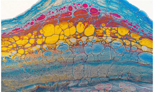 海外医疗：有关默克尔细胞癌的情况及介绍