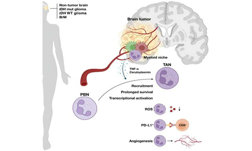 海外医疗：脑瘤如何使某些免疫细胞产生反应
