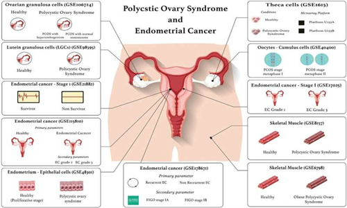 四种新受体可能将子宫内膜癌与 PCOS 联系起来
