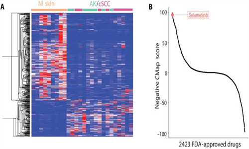 专家发现 NFX-179 可防止皮肤鳞状细胞癌发展
