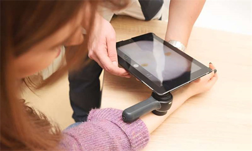 海外医疗：人工智能越来越擅长检测皮肤癌