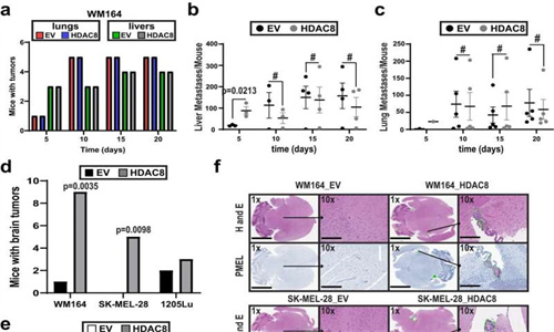 控制黑色素瘤细胞向大脑转移的细胞信号通路