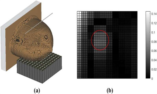 海外医疗：新方法可在两分钟内检测出早期乳腺癌