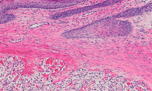 海外医疗：支持肿瘤学新理论方法的数学命题