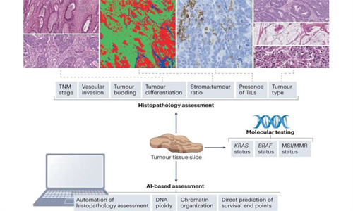 结合标志物和 ctDNA，可对结肠患者个体化治疗