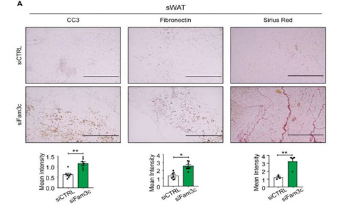 出国看病：有关 FAM3C 在乳腺癌进展中的关键作用