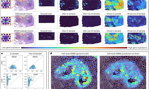 智能工具为癌症等疾病带来了更快的精确病理学