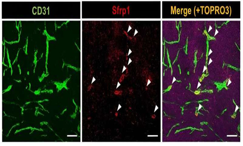 研究将血管分泌的蛋白质与耐药性癌症联系起来
