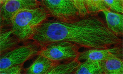 专家阐明了 KIM-1 作为肾细胞癌标志物的潜在作用