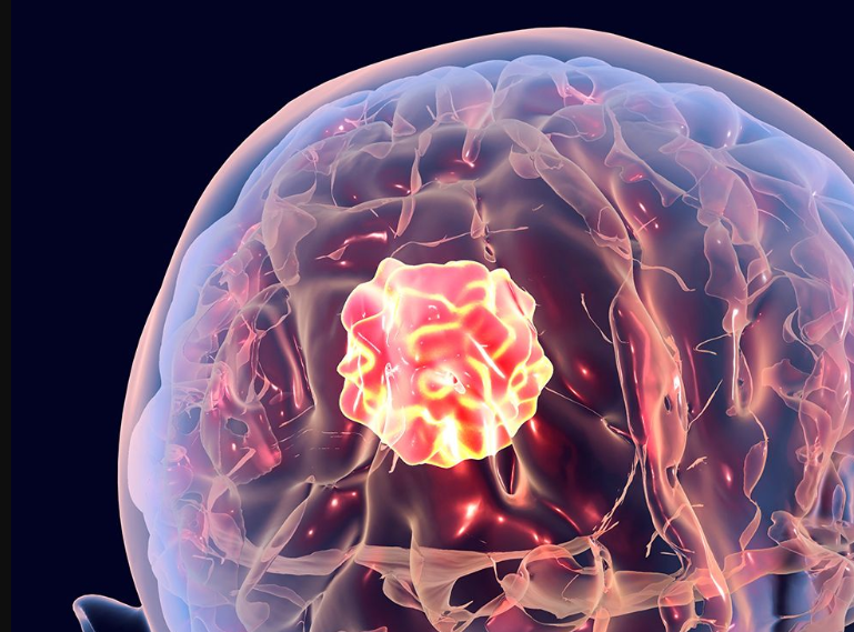 FDA接受Padcev Plus Keytruda用于某些膀胱癌症患者的申请